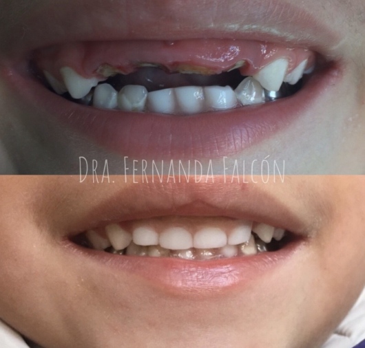 Dientes