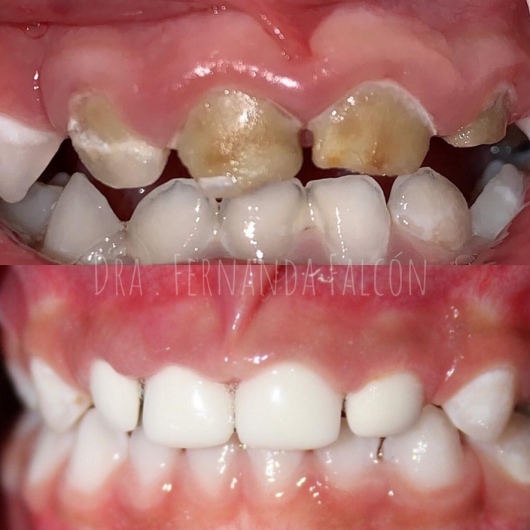 Dientes